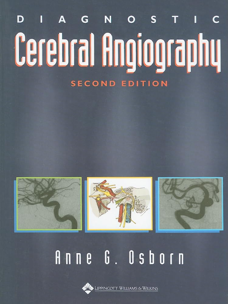 Angiografía Cerebral Diagnóstica