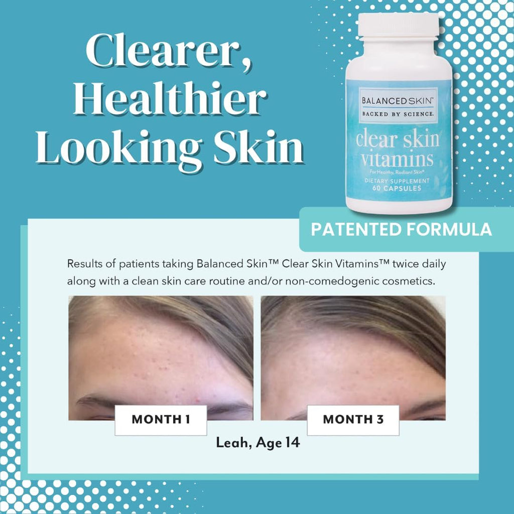 Clear Skin Vitaminas para Piel Clara y Acné - Suplemento para Hombres y Mujeres