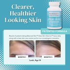Clear Skin Vitaminas para Piel Clara y Acné - Suplemento para Hombres y Mujeres