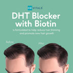 HK Vitals DHT Blocker con Biotina, Ortiga y Proteína de Soja - 60 Comprimidos