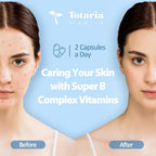 13-in-1 Vitamin B Complex Plus con Vitaminas B1, B2, B3, B4, B5, B6, B7, B8, B9, B12, C, D3, K2 - 120 Cápsulas por Frasco - 2 Frascos