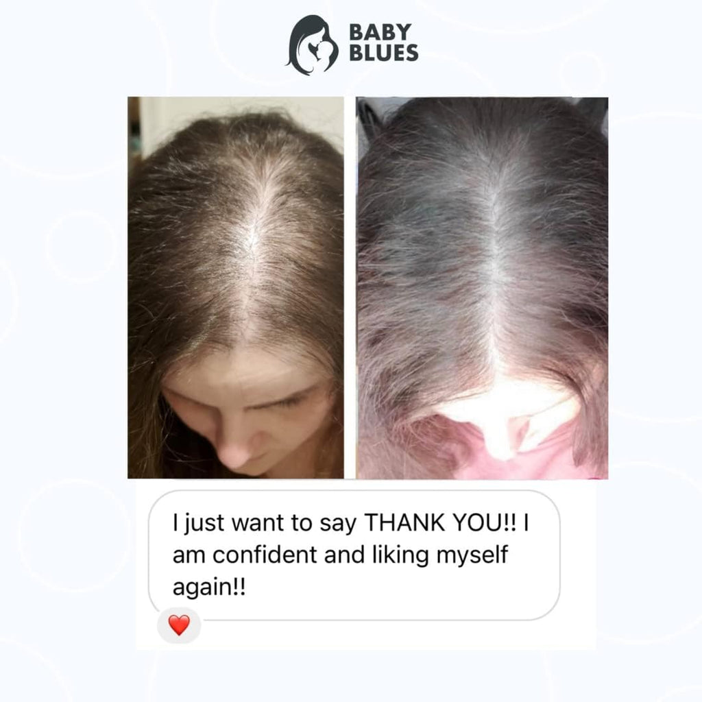 Baby Blues Vitaminas Postparto para la Caída del Cabello, Gomitas con Biotina y Colágeno, 180 unidades (Suministro para 3 Meses)