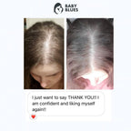 Baby Blues Vitaminas Postparto para la Caída del Cabello, Gomitas con Biotina y Colágeno, 180 unidades (Suministro para 3 Meses)
