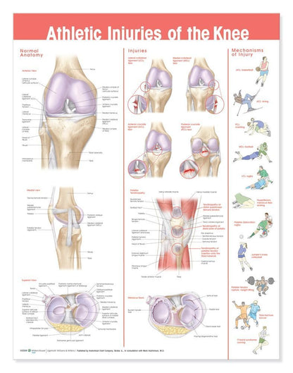 Athletic Injuries of the Knee Anatomical – Laminado resistente: Protegido contra el desgaste, fácil de limpiar y – Image 2
