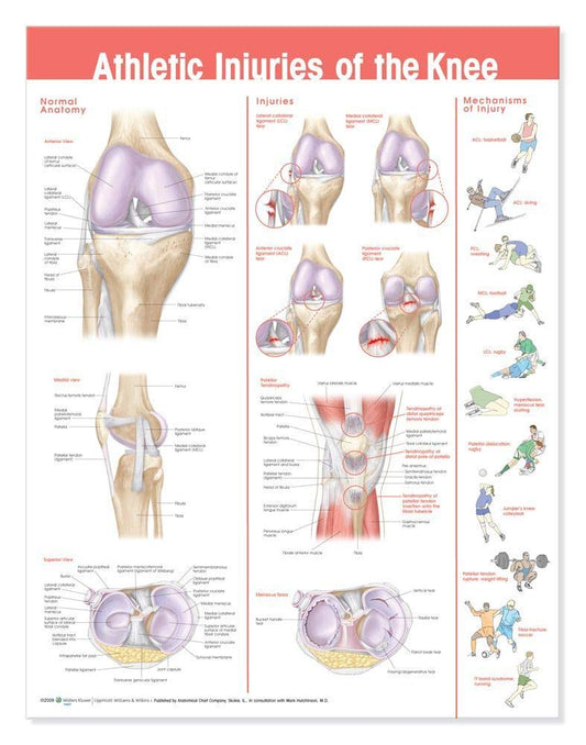 Lámina anatómica de lesiones deportivas de rodilla