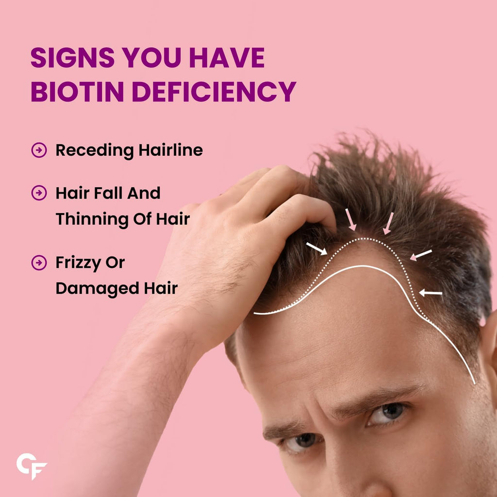 Carbamide Forte Biotinova Biotina 10000mcg - 120 Comprimidos Veganos