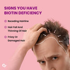 Carbamide Forte Biotinova Biotina 10000mcg - 120 Comprimidos Veganos