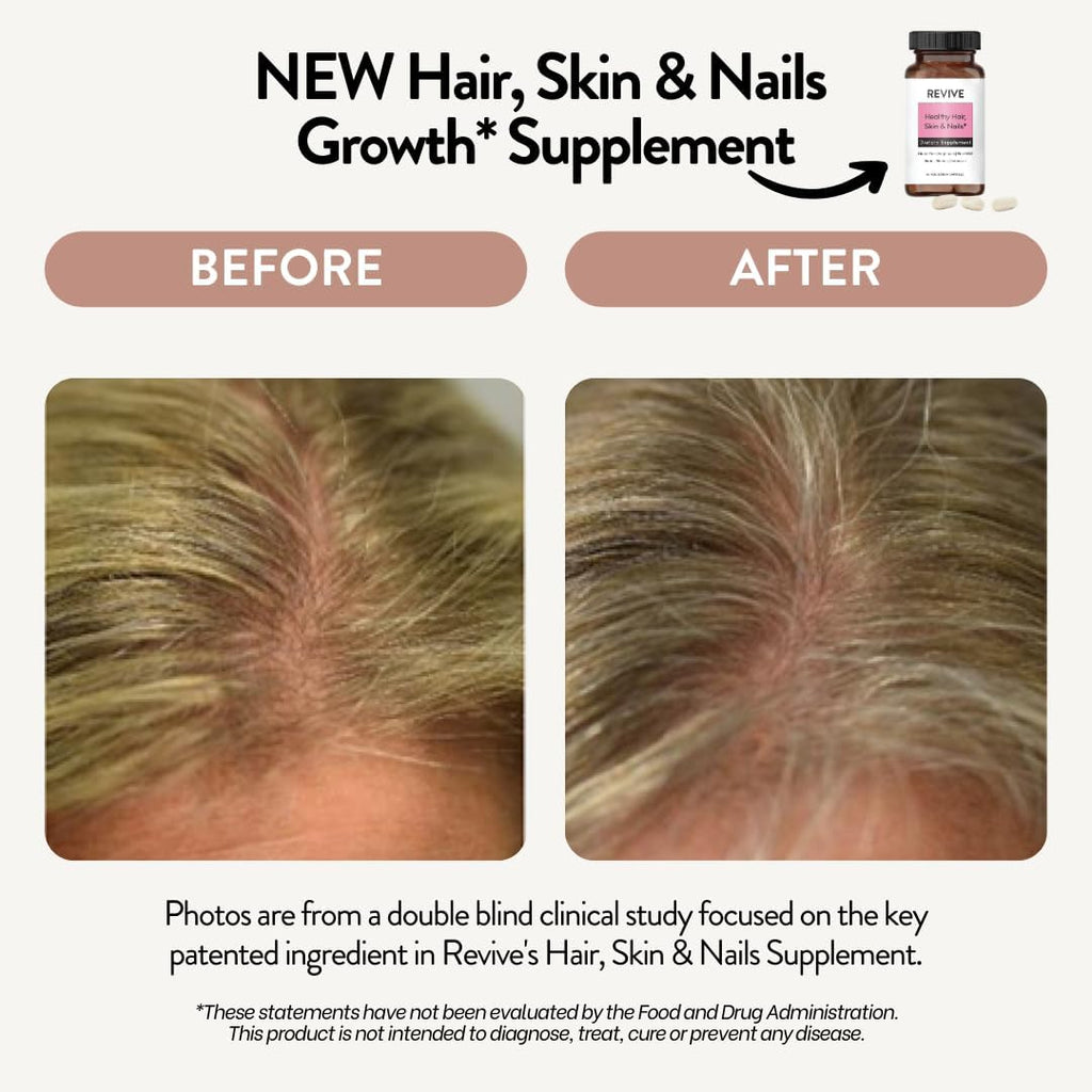 Suplemento para Piel, Cabello y Uñas - Revive Essential Oils - Con Biotina Patentada y Ashwagandha