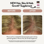 Suplemento para Piel, Cabello y Uñas - Revive Essential Oils - Con Biotina Patentada y Ashwagandha