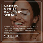 Dermawonder Vitiligo Capsules 60 Cápsulas | Suplemento para la Pigmentación de la Piel