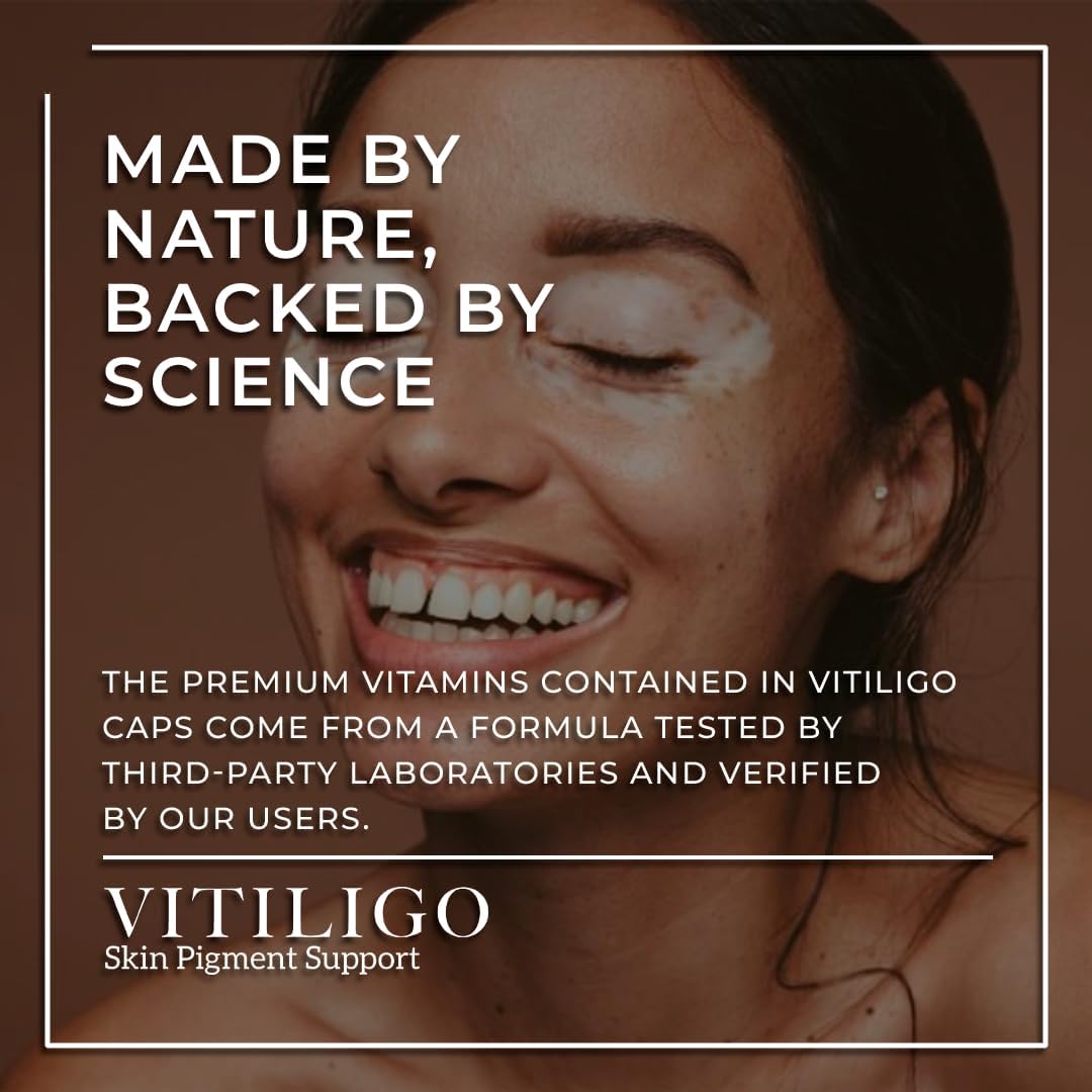 Dermawonder Vitiligo Capsules 60 Cápsulas | Suplemento para la Pigmentación de la Piel