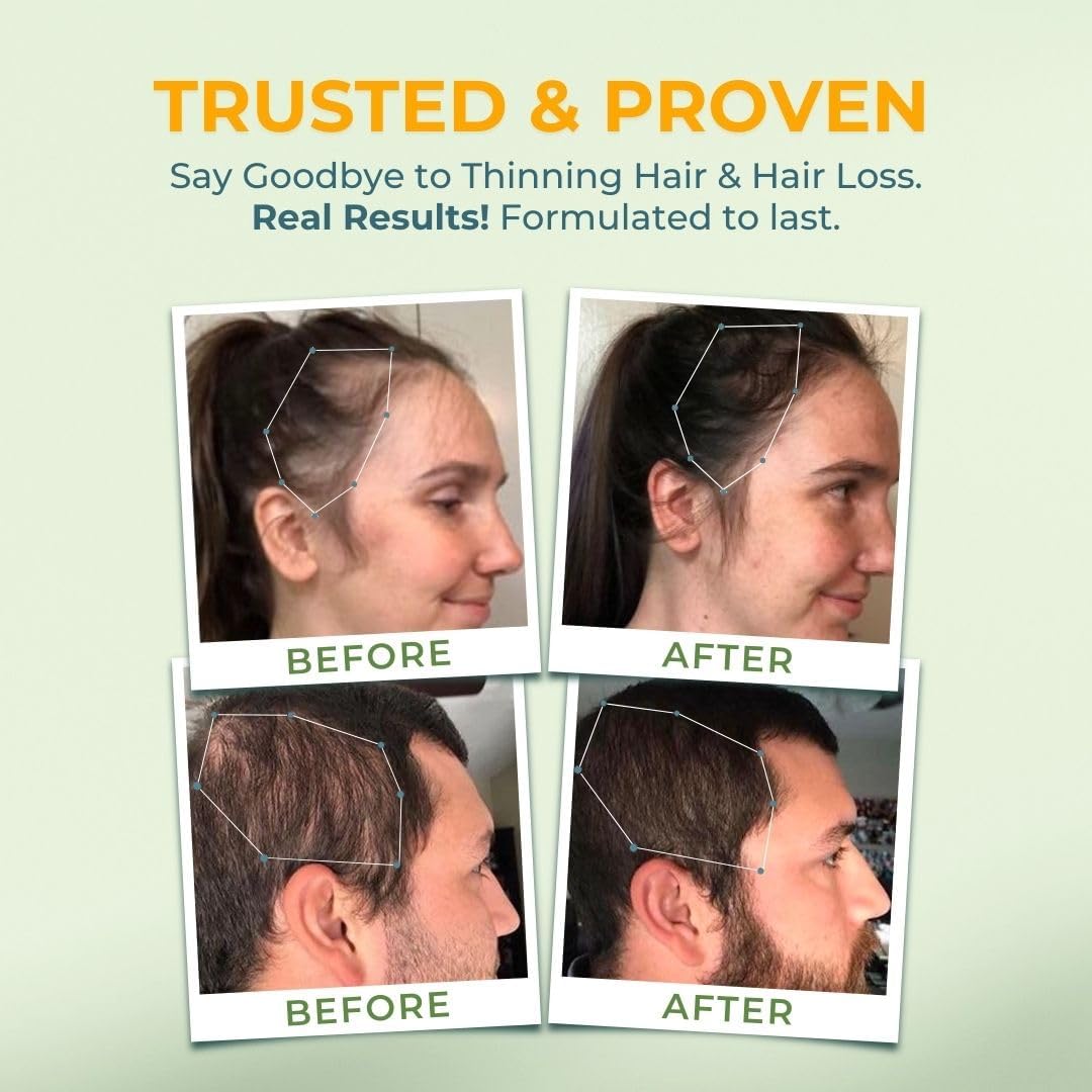 VITAL NUTRITIVE Vital Hair Complex – Biotina y Vitaminas B para Cabello, Piel y Uñas