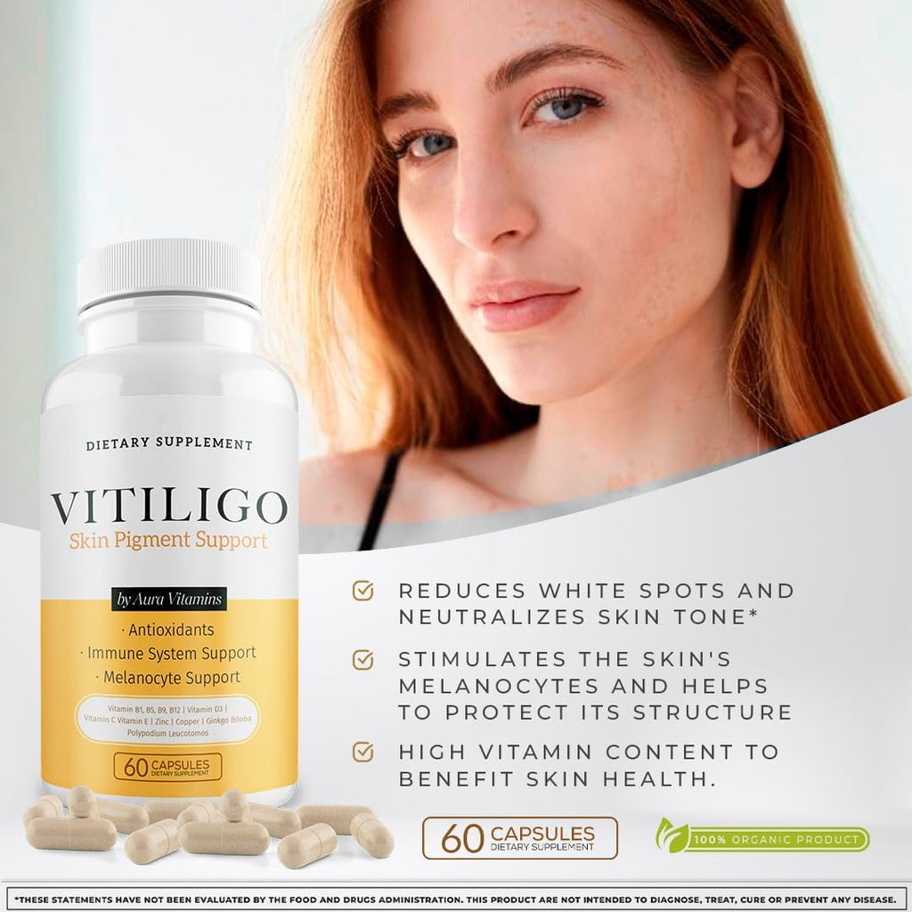 Dermawonder Vitiligo Capsules 60 Cápsulas | Suplemento para la Pigmentación de la Piel