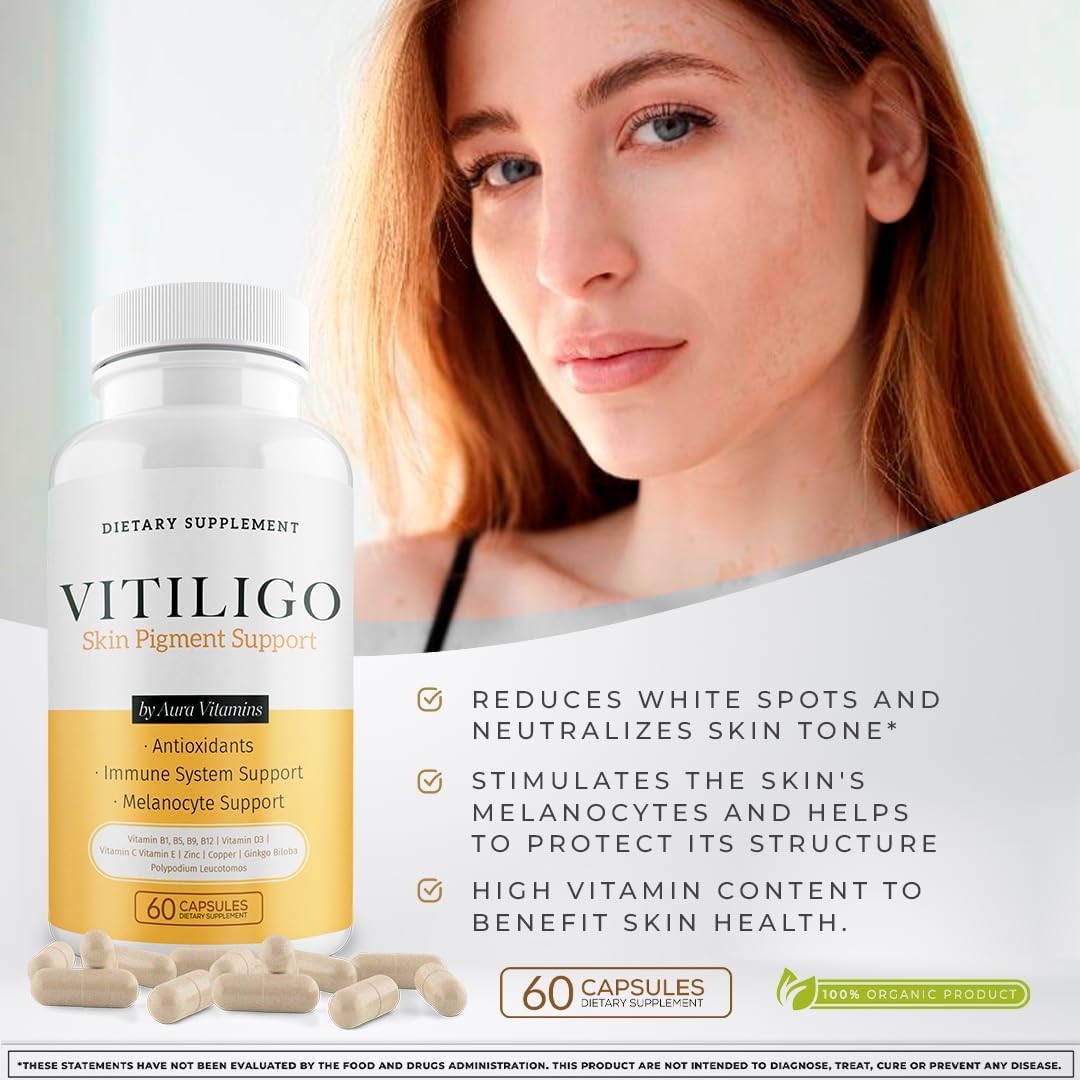 Dermawonder Vitiligo Capsules 60 Cápsulas | Suplemento para la Pigmentación de la Piel