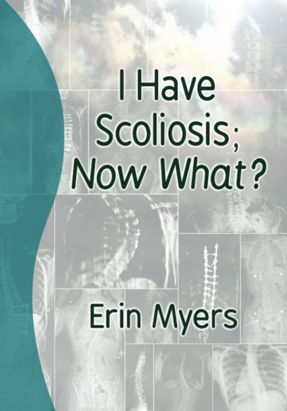 I Have Scoliosis; Now What? – Personas recién diagnosticadas con escoliosis que buscan orientación. – Image 1