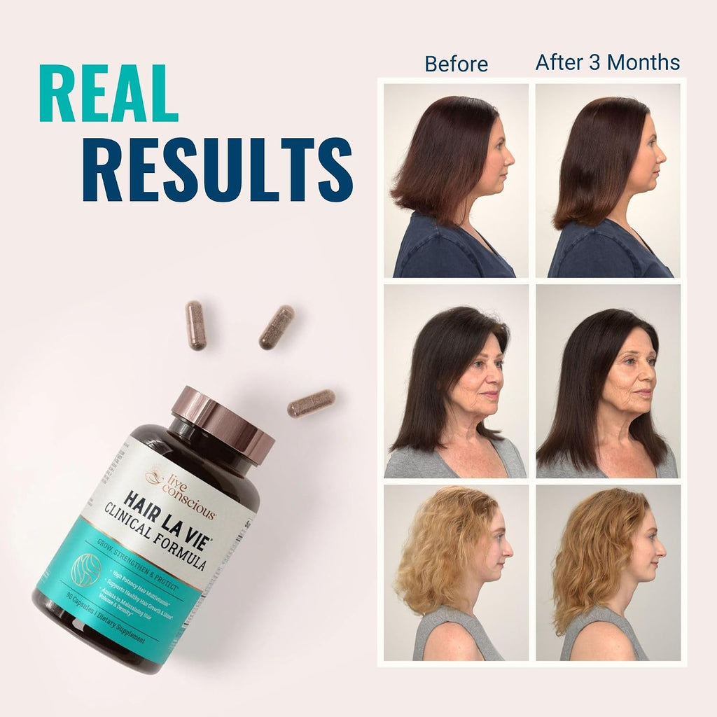 Hair La Vie Clinical Formula Vitaminas para el Cabello con Biotina y Saw Palmetto - Bienestar Capilar y General (Pack de 2)