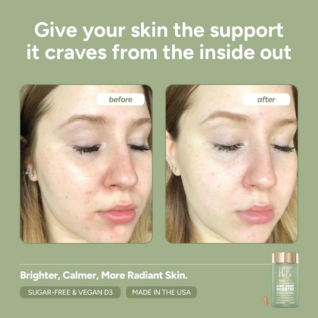 Halo Beauty Kiwi Seed Booster - Suplemento para la piel con kiwi, vitaminas C, D3, MSM y zinc, cápsulas veganas (30 unidades)