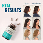 Hair La Vie Clinical Formula Vitaminas para el Crecimiento del Cabello, Mujeres y Hombres