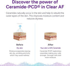 Clear AF Clear Skin Supplement – Apoyo para la Barrera Cutánea, Hidratación y Complexión Saludable con Ceramidas Veganas, Zinc, Vitamina D3, B6, Riboflavina y Tiamina – Cápsulas Veganas – 30 Días