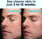 VitaMedica Clear Skin Vitamin Formula – Suplemento vitamínico para una piel sana | 60 cápsulas