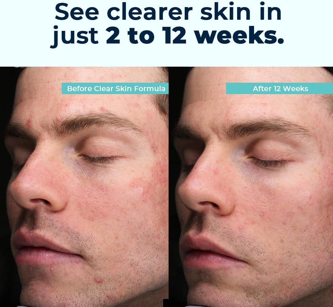 VitaMedica Clear Skin Vitamin Formula – Suplemento vitamínico para una piel sana | 60 cápsulas