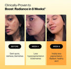 SETU Skin Renew Gluta Fizz: Glutatión con Vitamina C, 30 Comprimidos Efervescentes Sabor Naranja