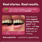 Strong Jaw Gum Restore - Suplemento para la Salud de Encías y Dientes, 180 Cápsulas