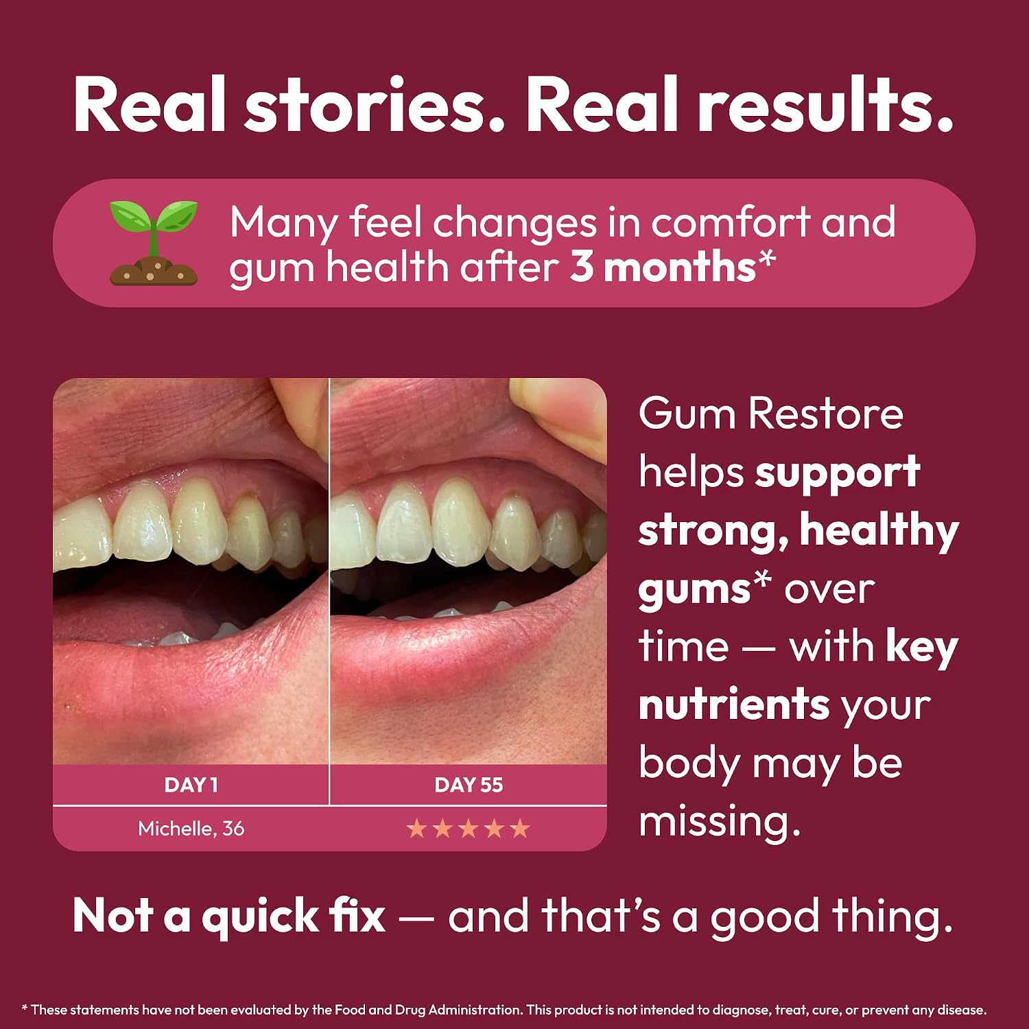Strong Jaw Gum Restore - Suplemento para la Salud de Encías y Dientes, 180 Cápsulas