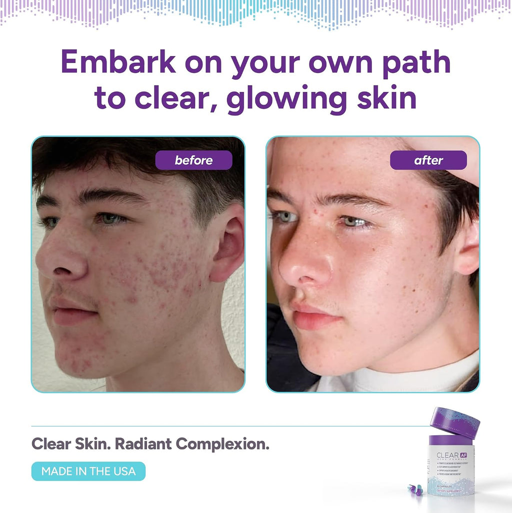 Clear AF Clear Skin Supplement – Apoyo para la Barrera Cutánea, Hidratación y Complexión Saludable con Ceramidas Veganas, Zinc, Vitamina D3, B6, Riboflavina y Tiamina – Cápsulas Veganas – 30 Días