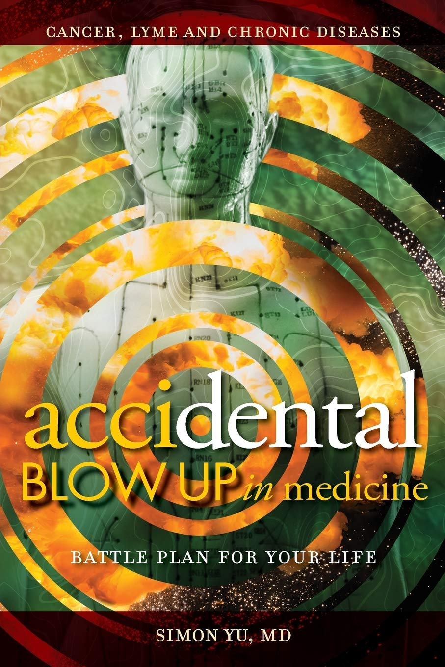 AcciDental Blow Up en Medicina: Plan de Batalla para su Vida (Acupuntura Médica)