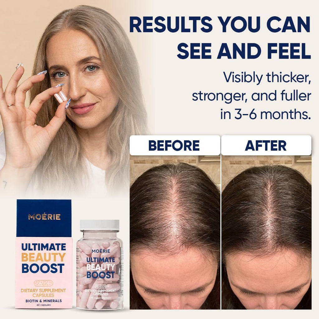 Moerie Ultimate Hair Boost - Complementos para Cabello, Piel y Uñas con Biotina y Minerales - 180 Cápsulas