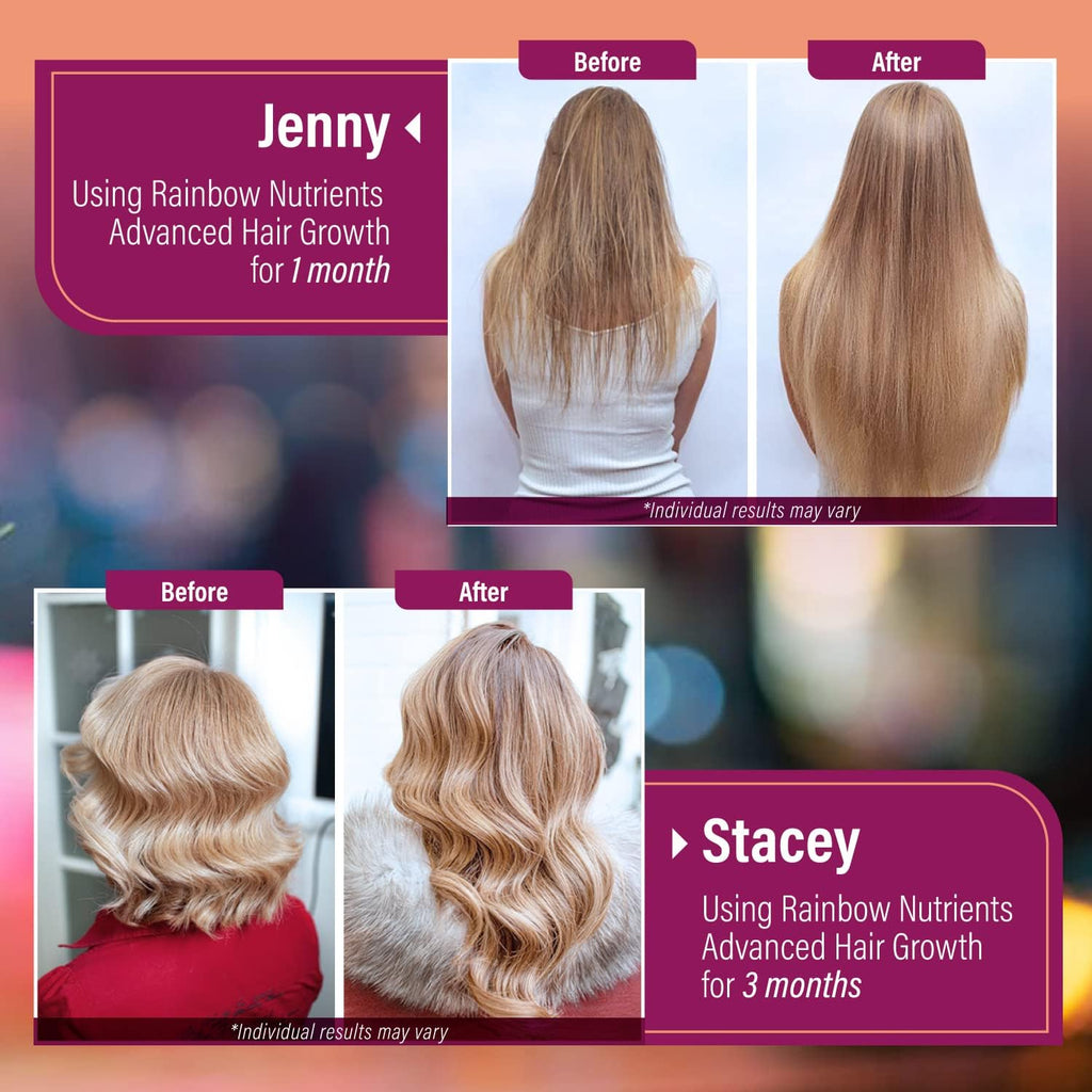 Vitaminas para el Crecimiento del Cabello para Mujeres con Biotina 10.000 mcg, Colágeno, OptiMSM, goMCT y Saw Palmetto - 2 Envases