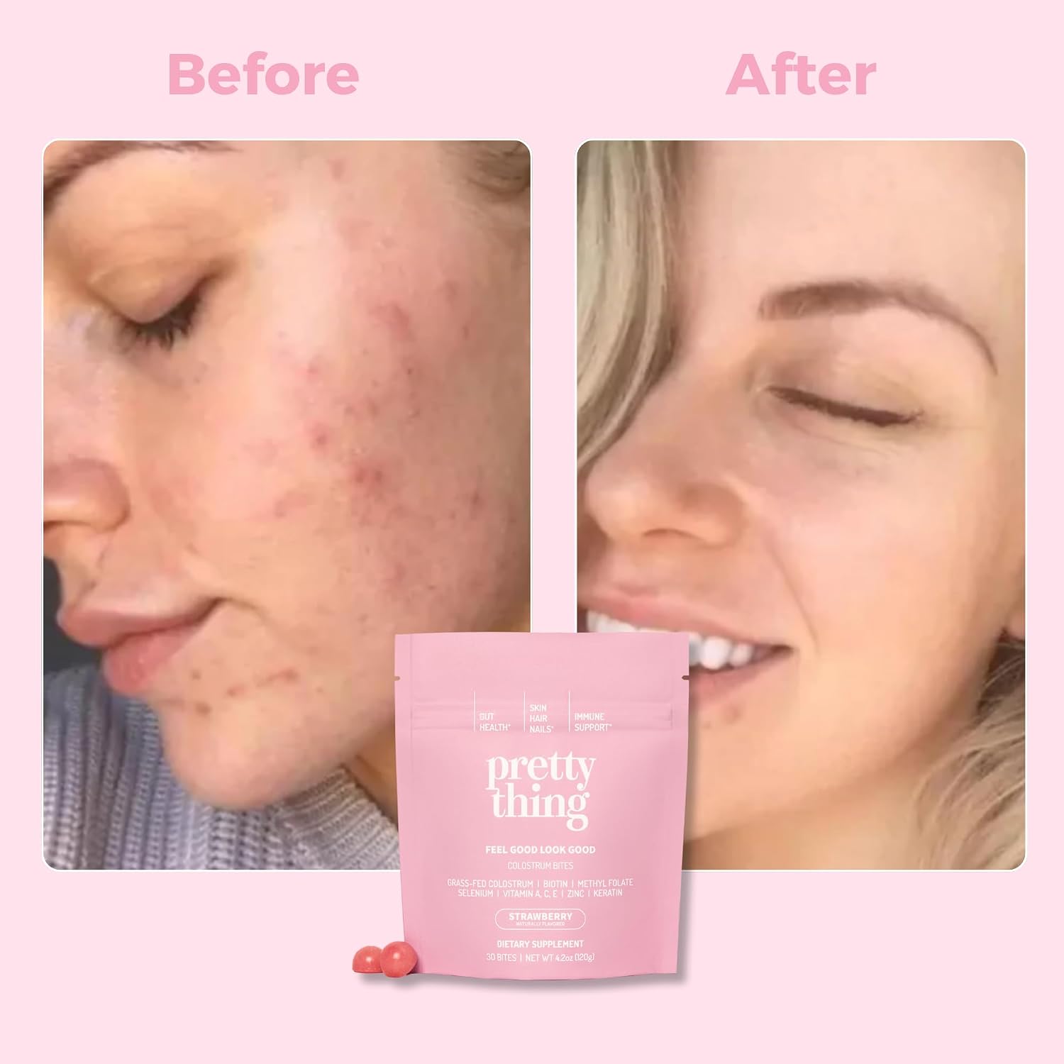 Pretty Thing Colostrum Bites para Mujer – 1g de Calostro Bovino con Biotina, Folato, Zinc y Vitaminas A, C, E – Suplemento de Belleza y Bienestar para Cabello, Piel y Sistema Inmunitario - 30 Bites