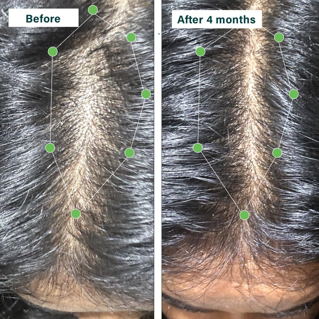 OZIVA Plant Based Hair Vitamins con Biotina, Omega-3 y Vitamina E, 60 Cápsulas