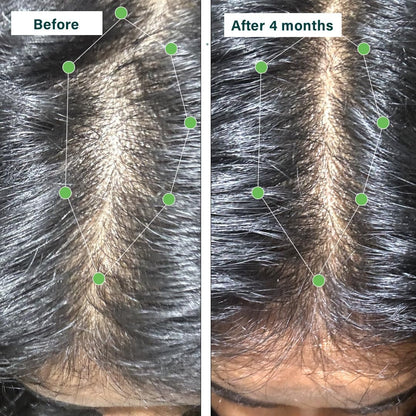 OZIVA Plant Based Hair Vitamins con Biotina, Omega-3 y Vitamina E, 60 Cápsulas – Image 6