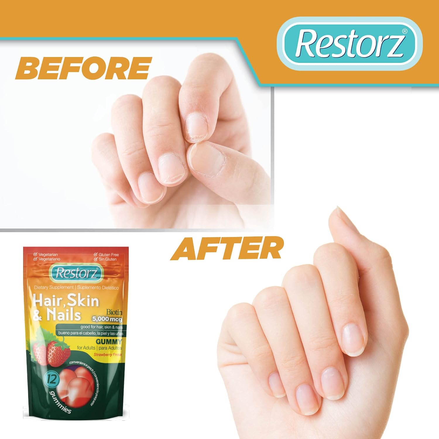 Restorz Gomitas de Biotina para Cabello, Piel y Uñas, Sabor Fresa (Pack de 12)