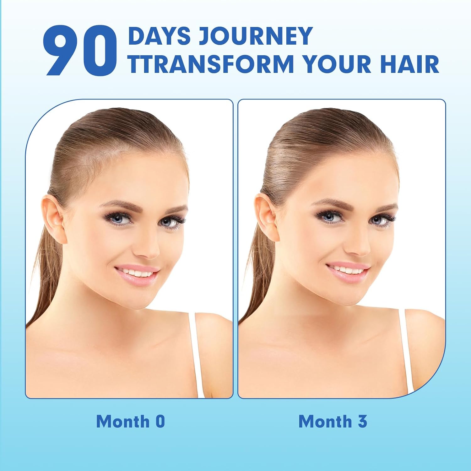 Vitaminas para la caída del cabello postparto, Gominolas veganas con biotina, colágeno y folato, 60 gominolas