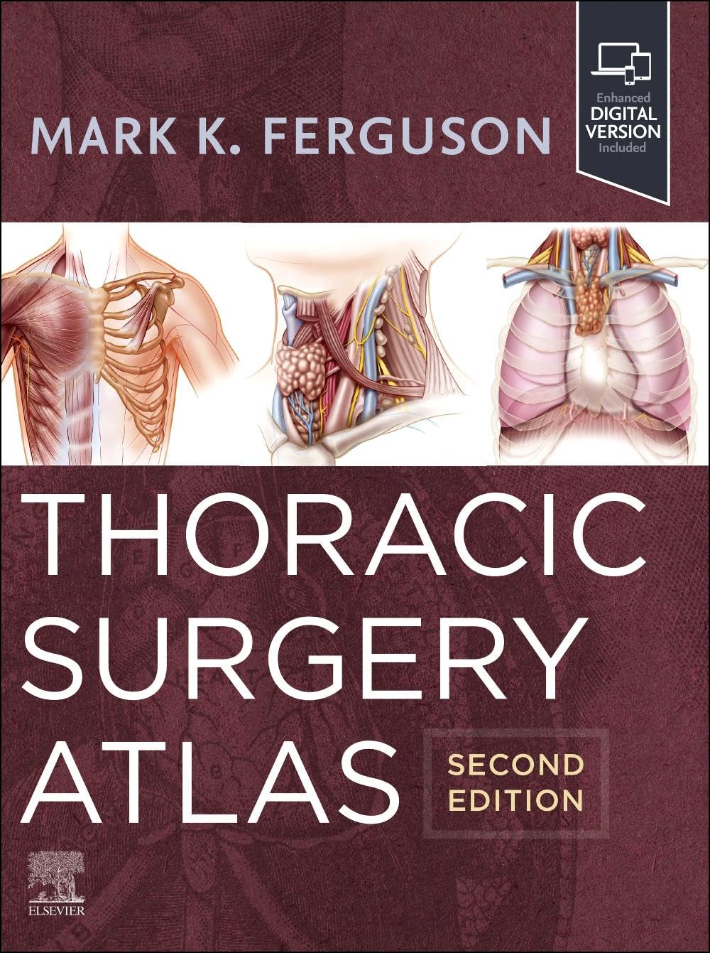 Atlas de cirugía torácica