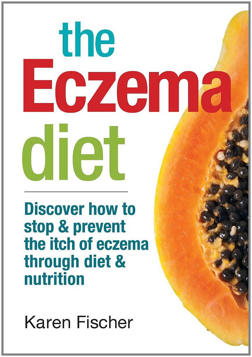 La dieta para el eccema: Descubre cómo detener y prevenir la picazón del eccema a través de la dieta y la nutrición