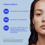Codex Labs Shaant Clear Skin Supplement – 60 Cápsulas Veganas | Mezcla probiótica de 9 cepas con EGCG de té verde y guggul, apoyo diario para piel propensa al acné