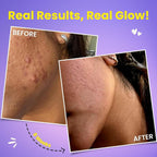 THRU Glow - Glutatión Japonés 500 mg y Vitamina C para el Cuidado de la Piel - 20 Comprimidos Efervescentes Sabor Fresa y Limón