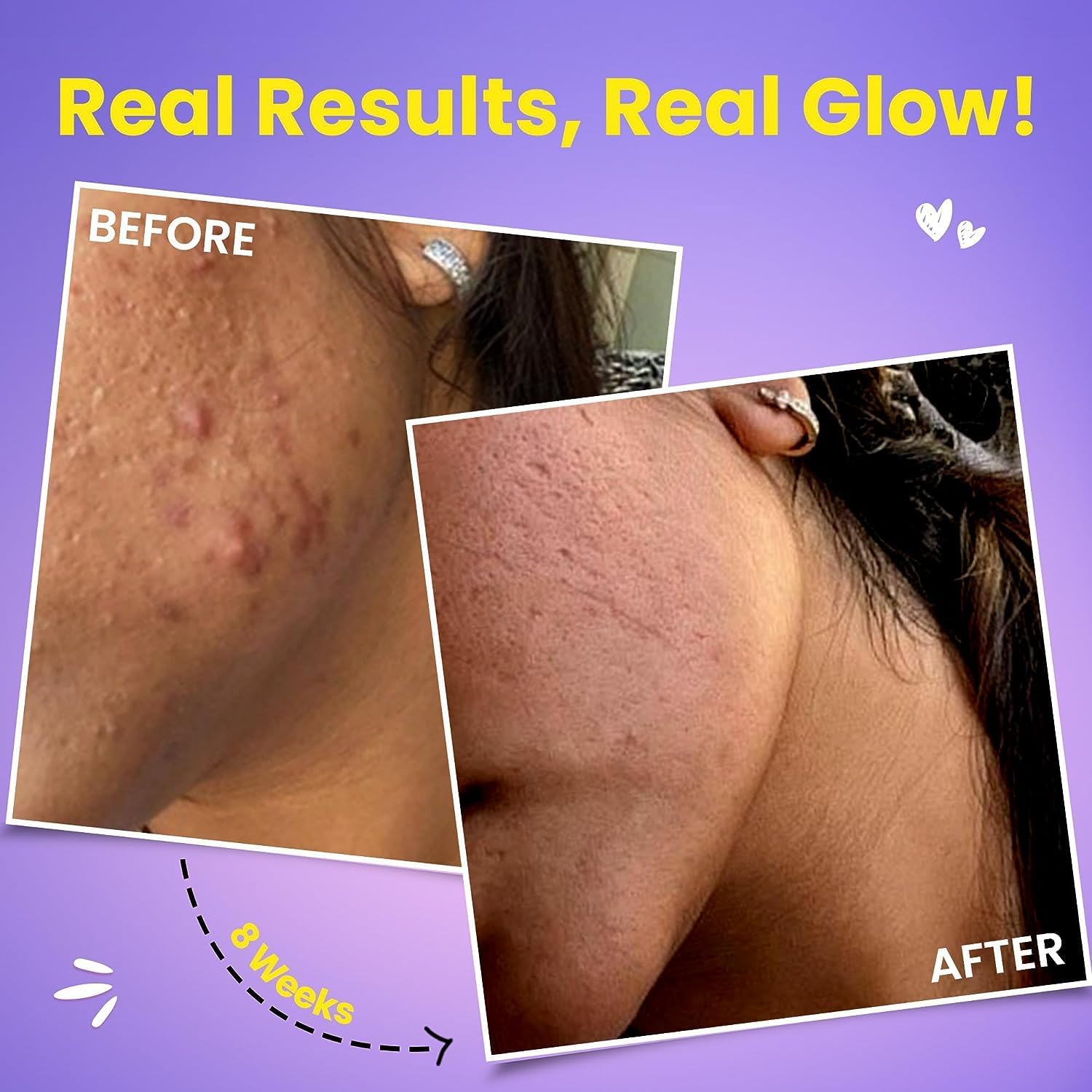 THRU Glow - Glutatión Japonés 500 mg y Vitamina C para el Cuidado de la Piel - 20 Comprimidos Efervescentes Sabor Fresa y Limón