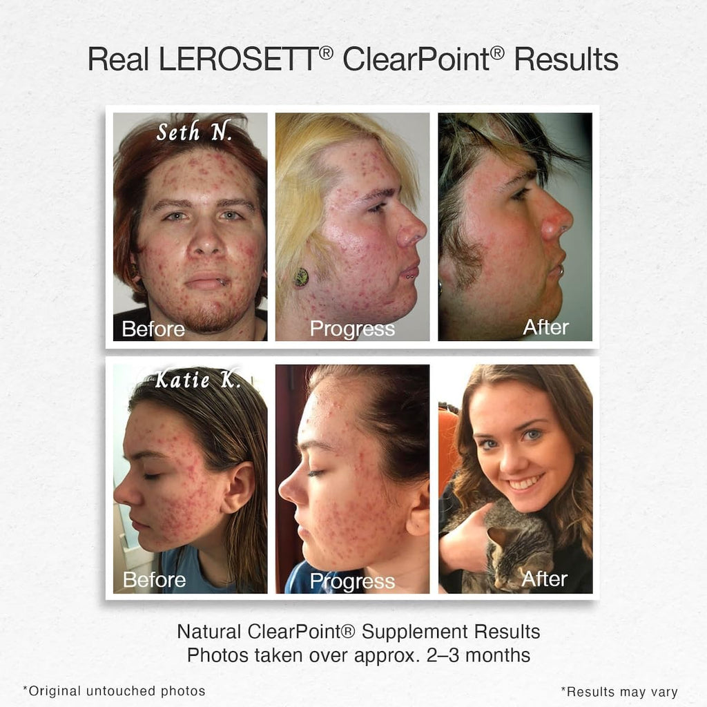 LEROSETT ClearPoint Anti Acne Pills, 60 Cápsulas - Gunilla Of Sweden