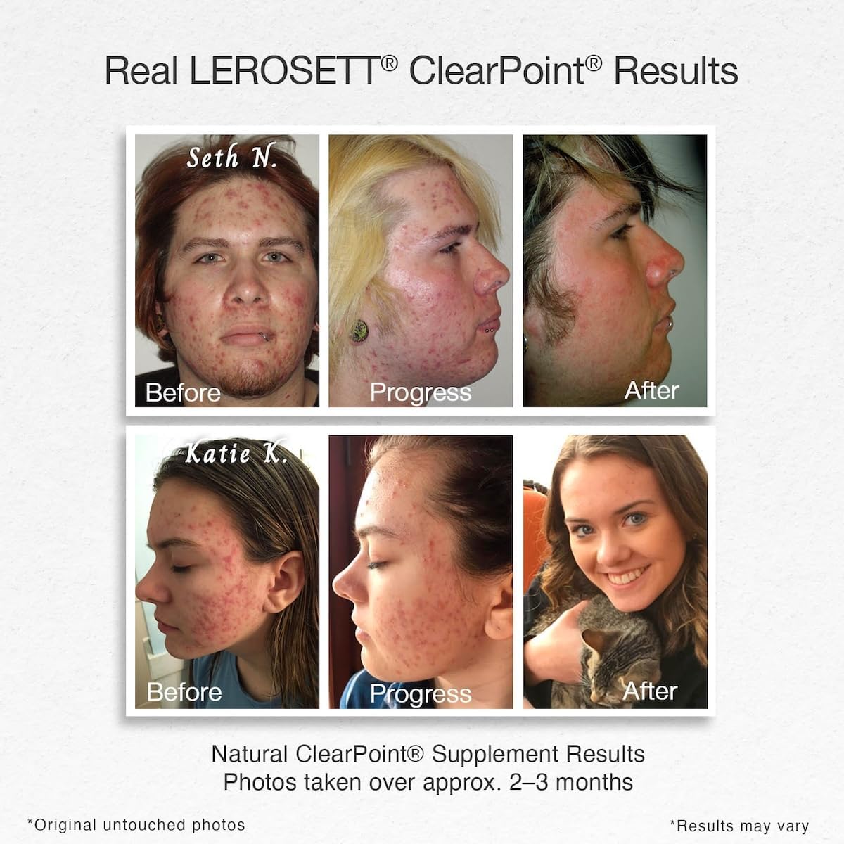 LEROSETT ClearPoint Anti Acne Pills, 60 Cápsulas - Gunilla Of Sweden