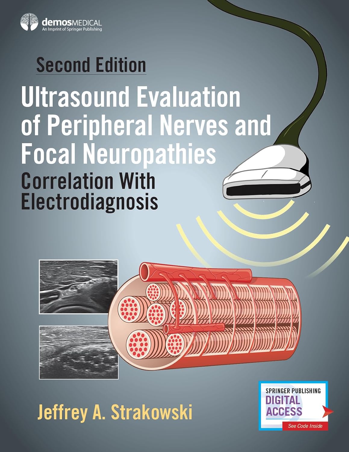 Ultrasound Evaluation of Peripheral Nerves – Segunda edición actualizada : con los últimos avances en – Image 1