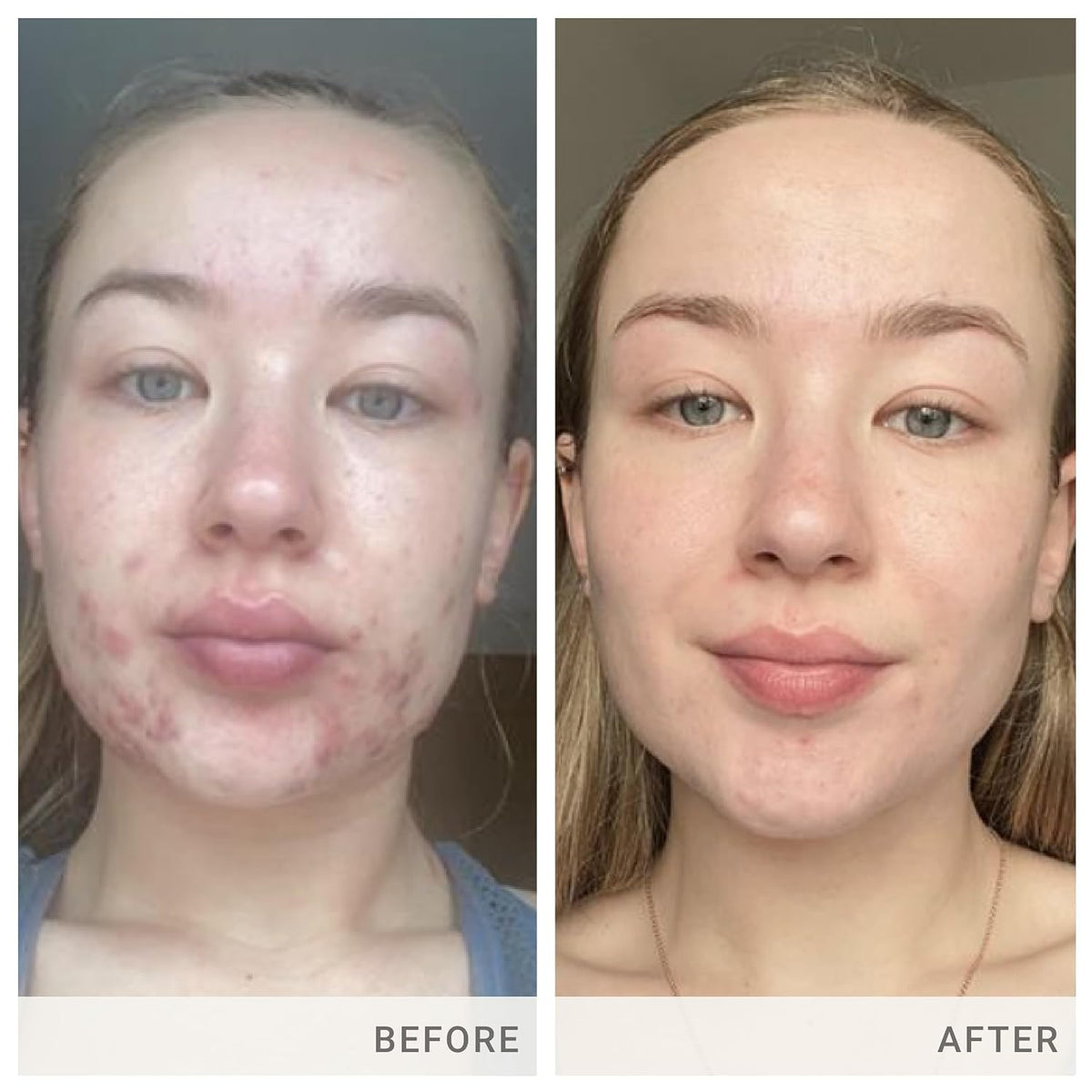 jane iredale Advanced Nutrition Programme – Vitamina A: Contribuye al mantenimiento de la piel en condiciones – Image 4