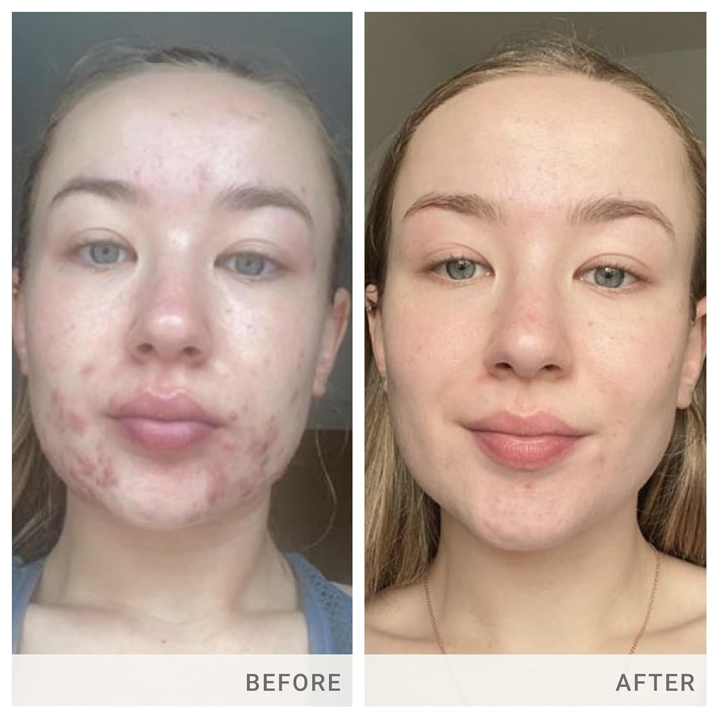 jane iredale Skin Accumax Suplemento Nutricional en Cápsulas - Vitaminas A, C y E - Vegano y Sin Gluten
