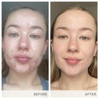 jane iredale Skin Accumax Suplemento Nutricional en Cápsulas - Vitaminas A, C y E - Vegano y Sin Gluten