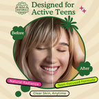 Acné Suplemento para Adolescentes con Vitaminas A, B, C, E y Biotina para una Piel Clara y Radiante, Apoya la Producción Equilibrada de Grasa - Sin Gluten, 60 Cápsulas