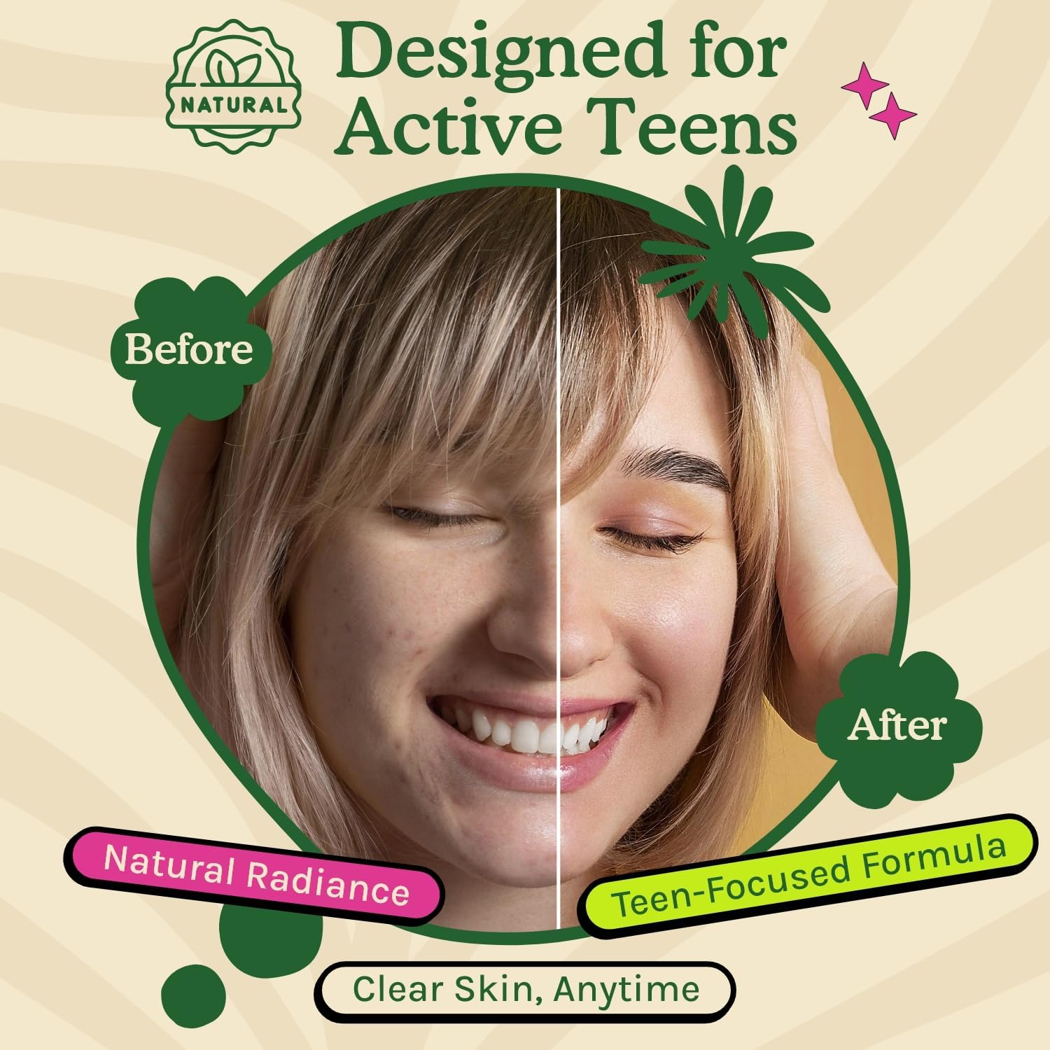 Acné Suplemento para Adolescentes con Vitaminas A, B, C, E y Biotina para una Piel Clara y Radiante, Apoya la Producción Equilibrada de Grasa - Sin Gluten, 60 Cápsulas